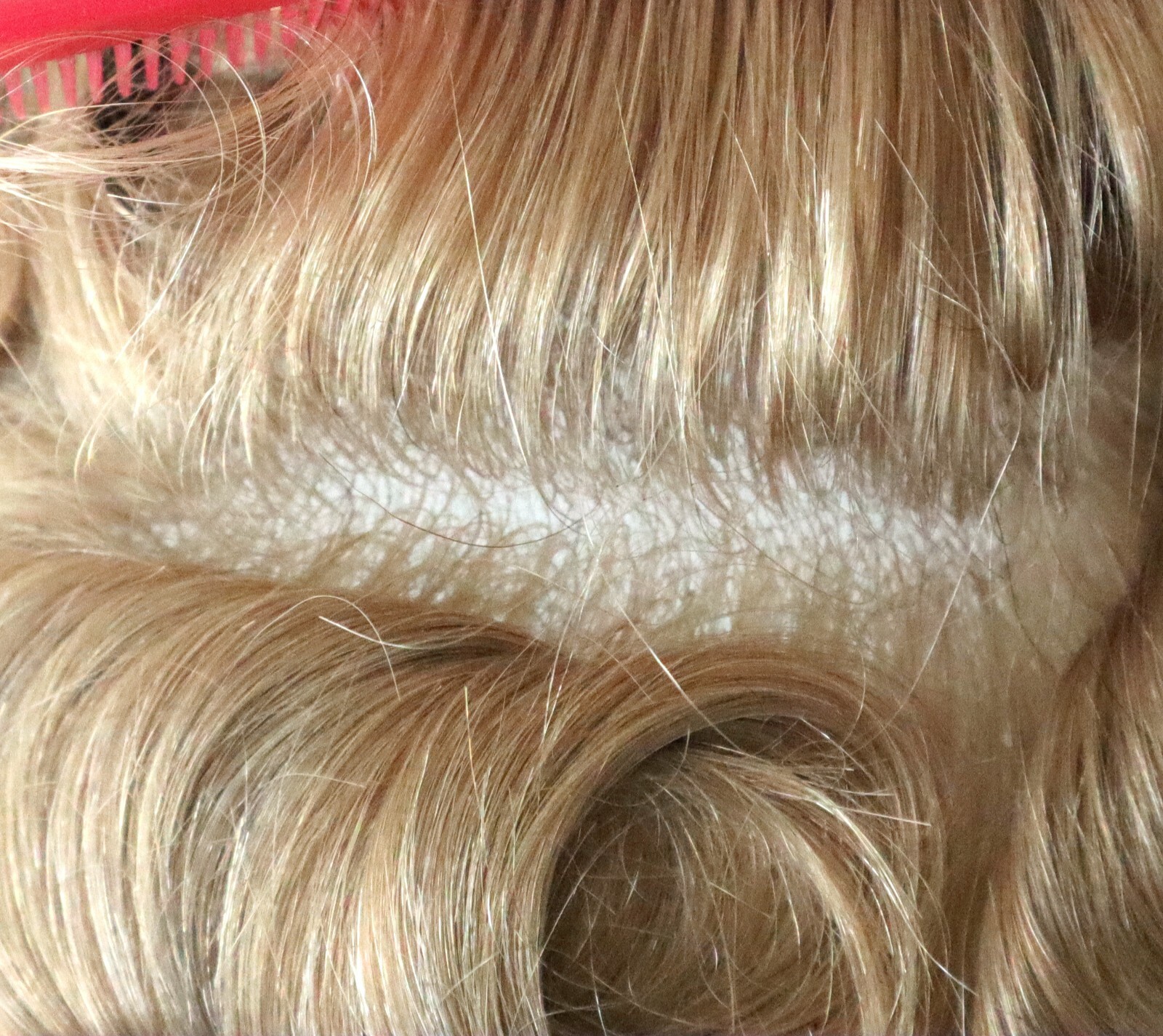 Mens Toupee Human Hairpieces Medium Poly Skin Hair System SKV Express Shipping