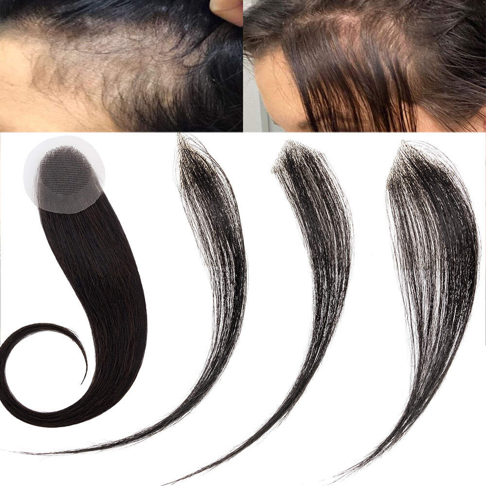 Full Lace / Skin Cover-up Human Hair Patches Patch Hairpiece for Alopecia Areata