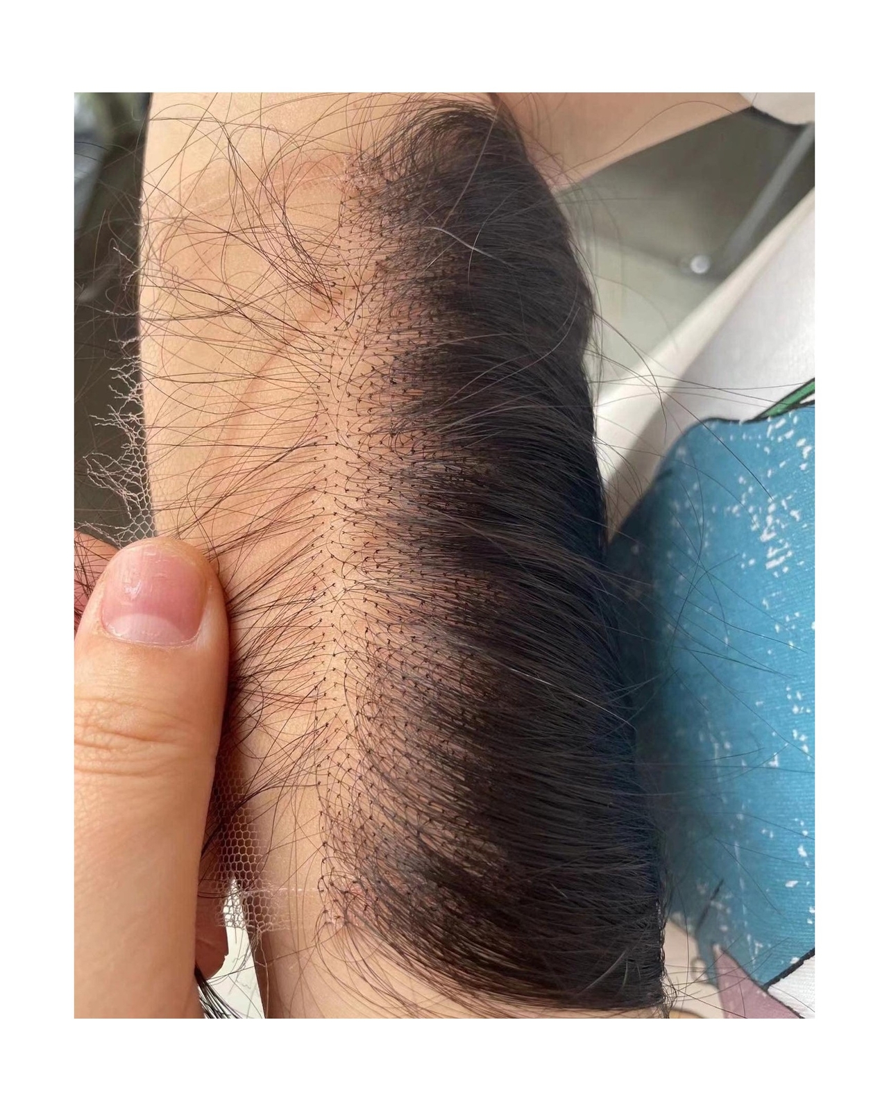 BEEOS SKINLIKE 5×5 HD Lace Closure Only, Deep Wave 0.10mm Ultra-thin Undetect…
