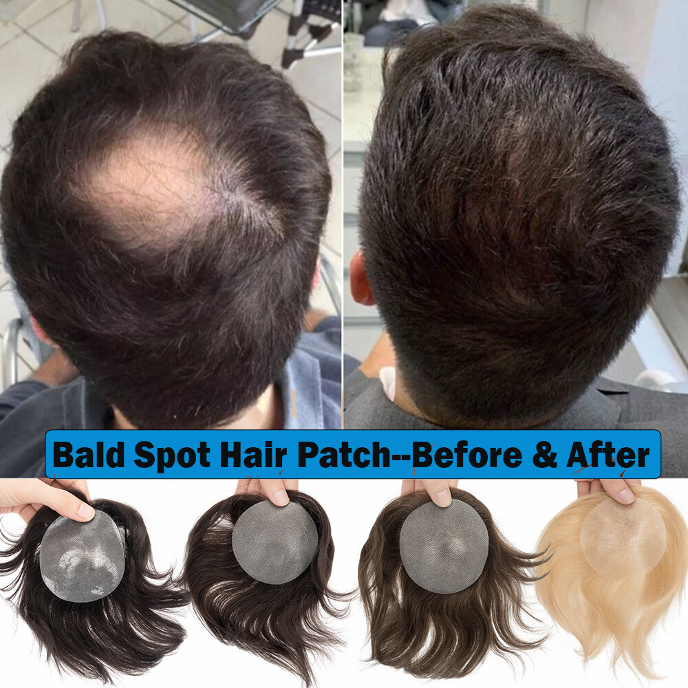 Men Frontal Hairline Temple Hair Patch Remy Human Hair Cover up Topper Bald Spot