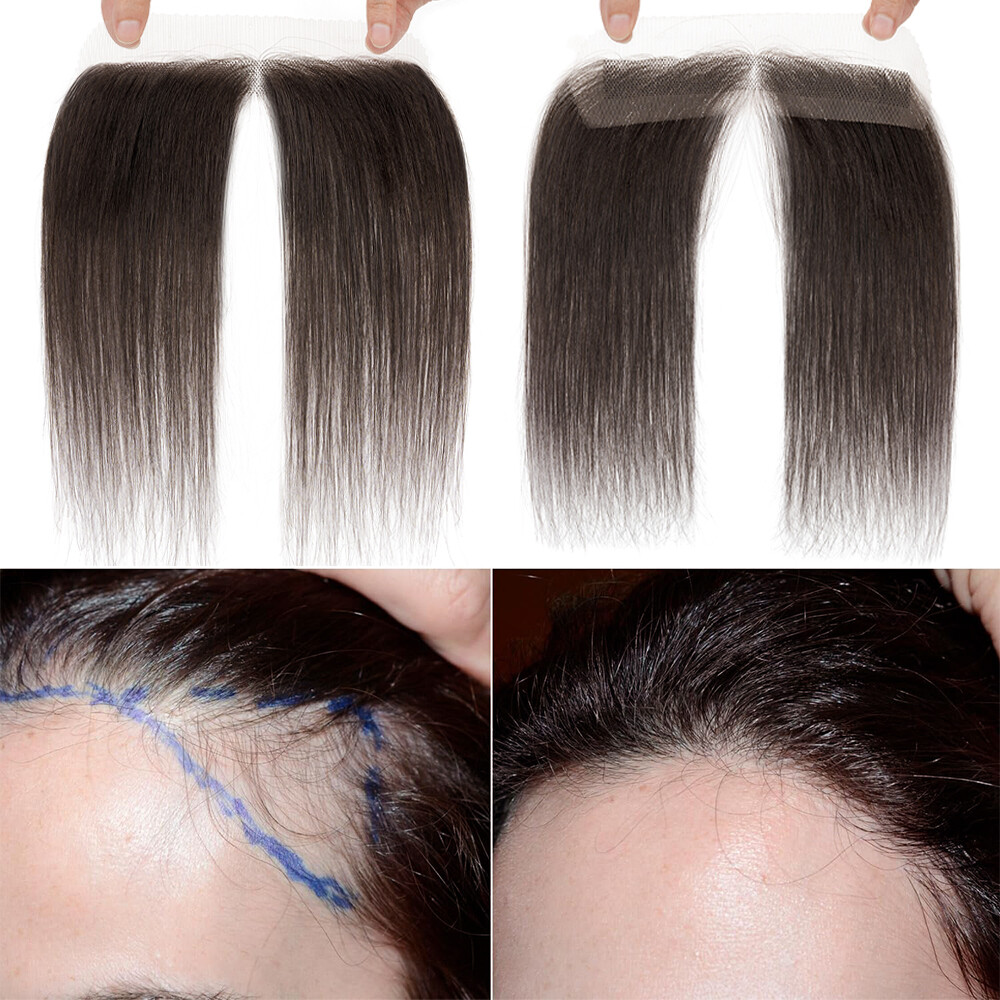 Full Lace Base 100% Remy Human Hair Patch Hairpiece for Front Hailine Hair Loss