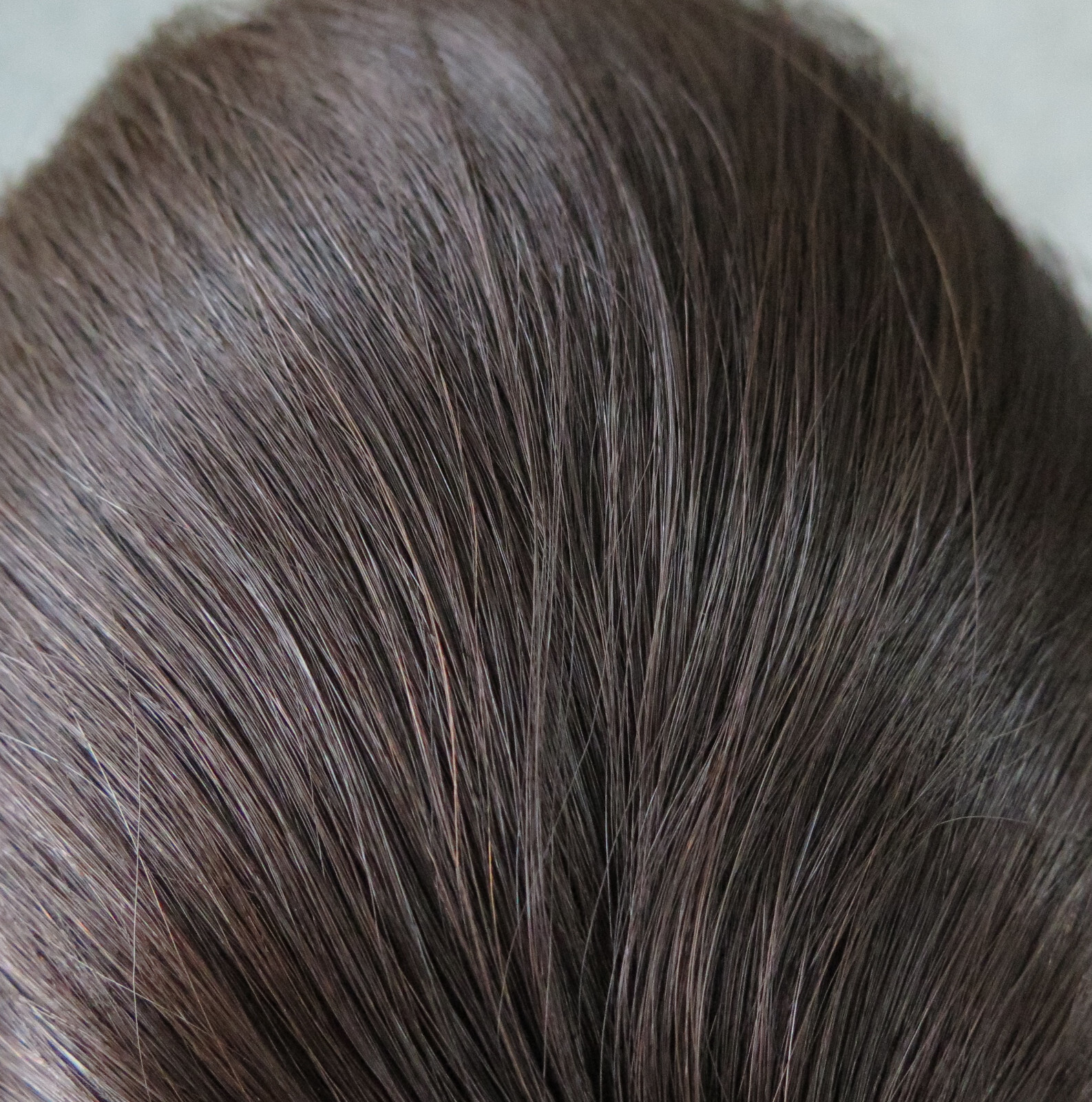 Mens Toupee Injected Skin European Human Hair Replacement System Hairpieces EJNC