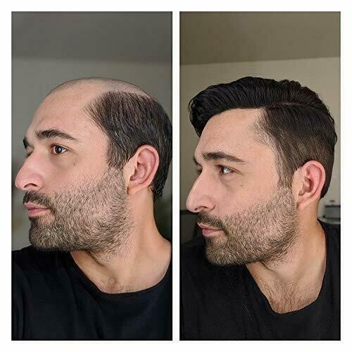 Mens Toupee French Lace Front Hairpiece Fine Mono Poly Skin Hair Systems FPM
