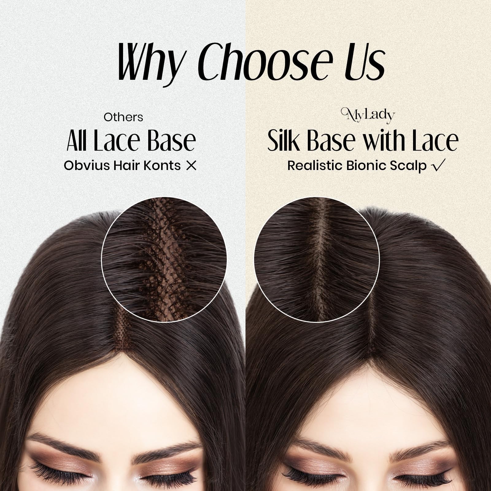 My-Lady Human Hair Toppers For Women Real Human Hair Thin 10 Silk Base Lace 130