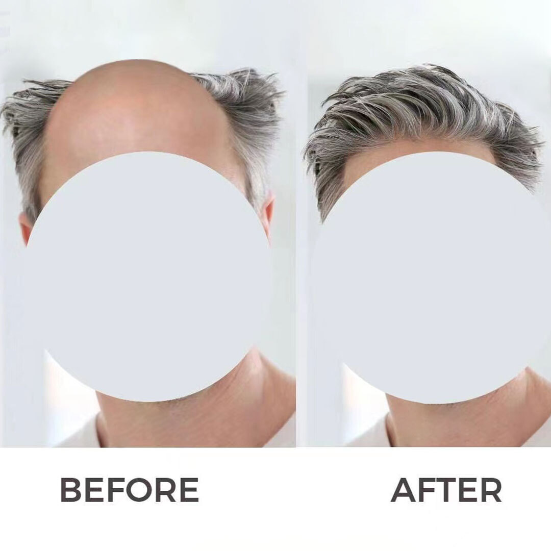 Toupee For Men Human Hair Replacement System Mono Thin Skin Pu 10×8