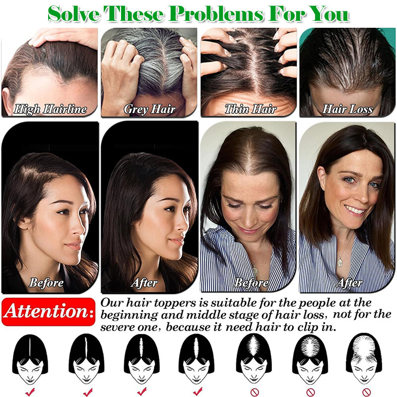 Free Part Clip In 100% Remy Human Hair Piece Top Topper Hand-Tied Lace Hairpiece