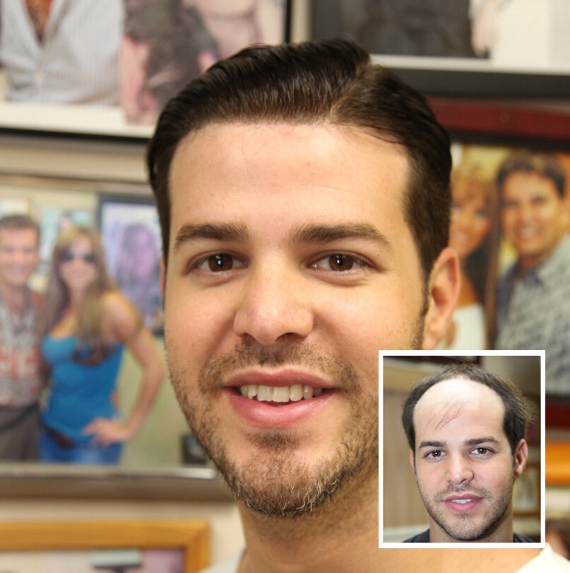 Mens Toupee Hair Replacement System French Lace Front Thin Skin Wig Hairpiece Q6