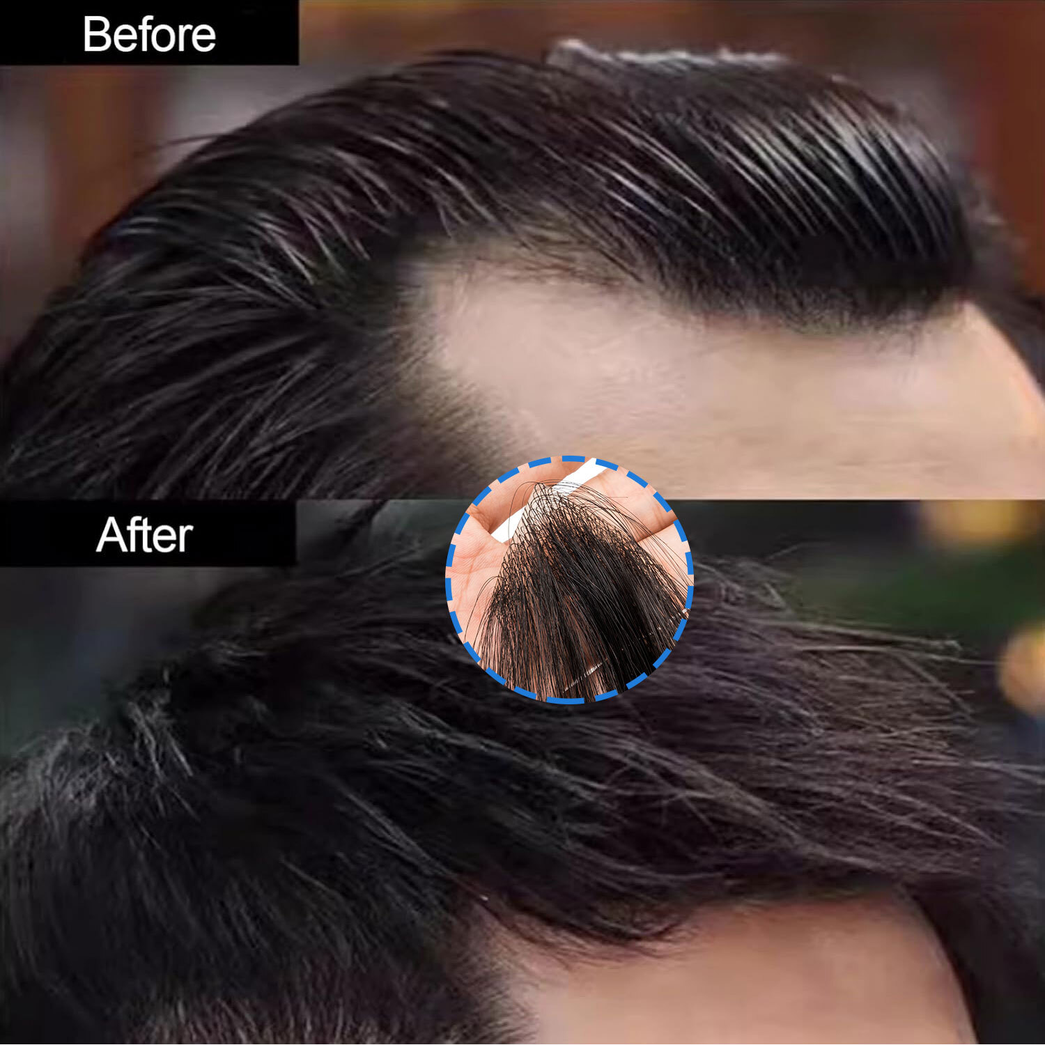 Front Hairline 100% Human Hair Patch Full Skin Base Cover-Up Topper Piece Toupee