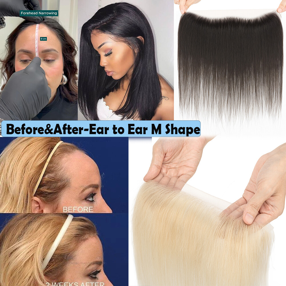 CLEARANCE Lace Topper Remy Human Hair Patch Toupee Women Receding Front Hairline