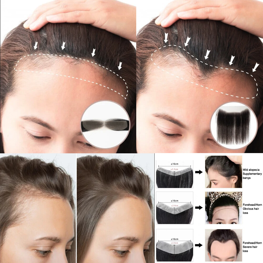 Handtied Lace Top Hairpiece Front Hairline Women’s Topper Toupee Cover Up Blonde