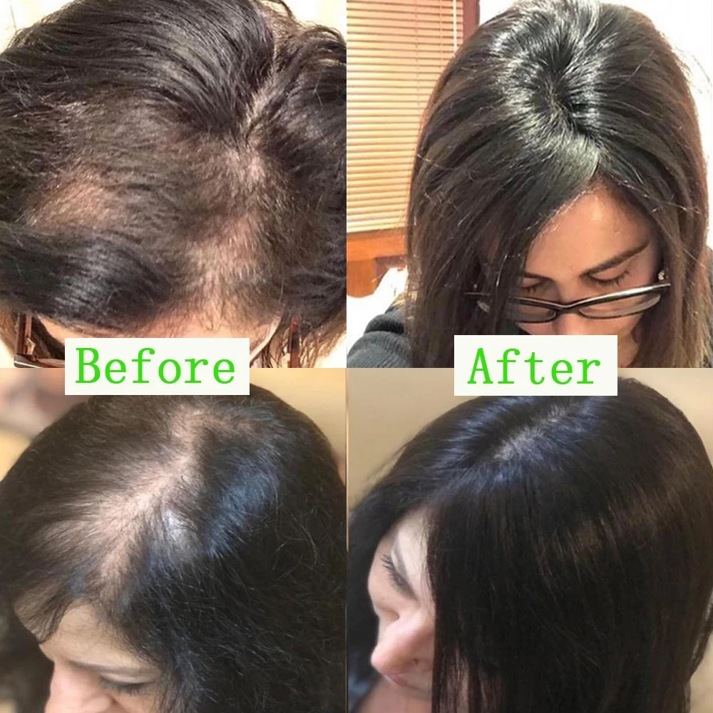 Medium Brown Clip In Human Hair Topper For Women Fashion Silk Top Hair Extension