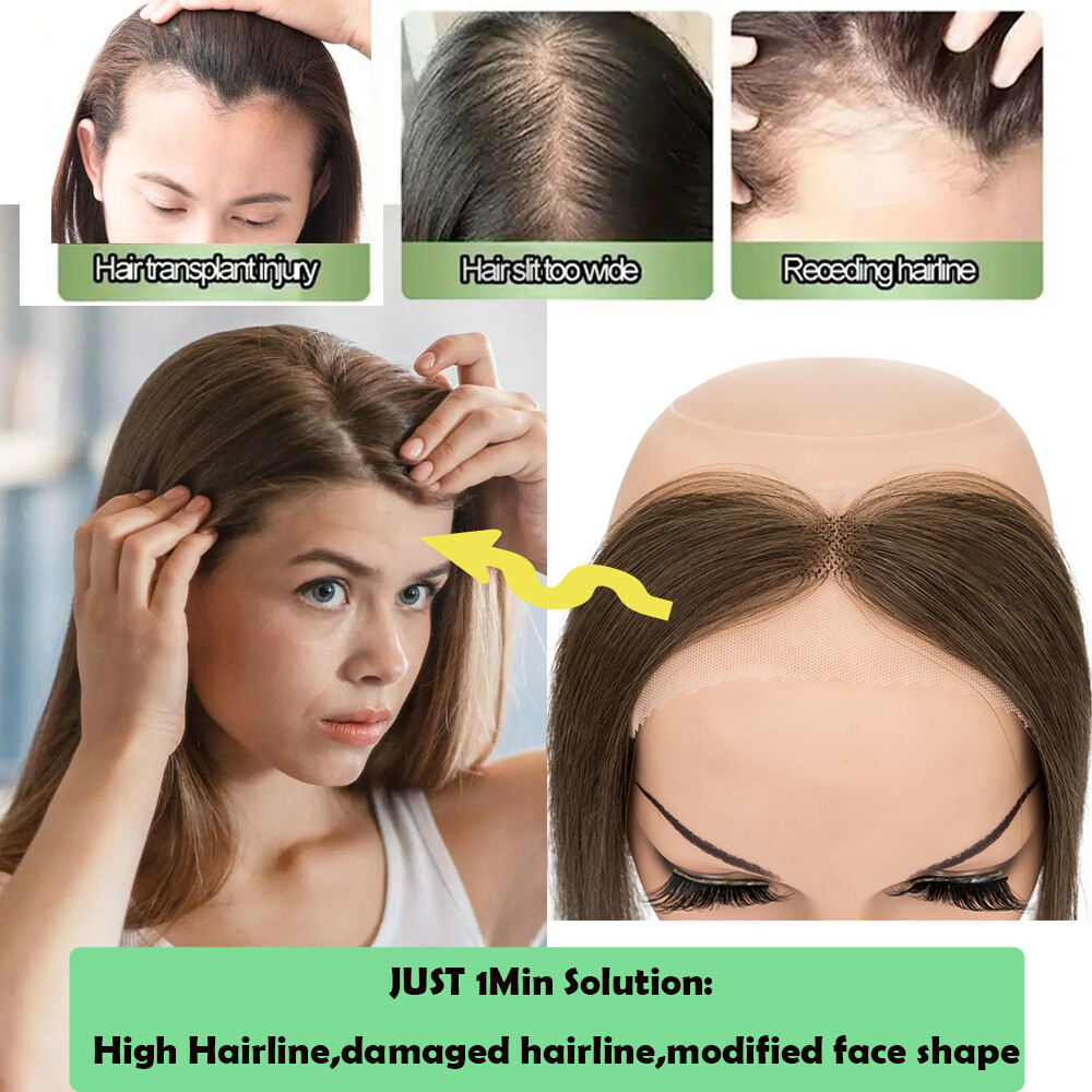 CLEARANCE Lace Topper Remy Human Hair Patch Toupee Women Receding Front Hairline
