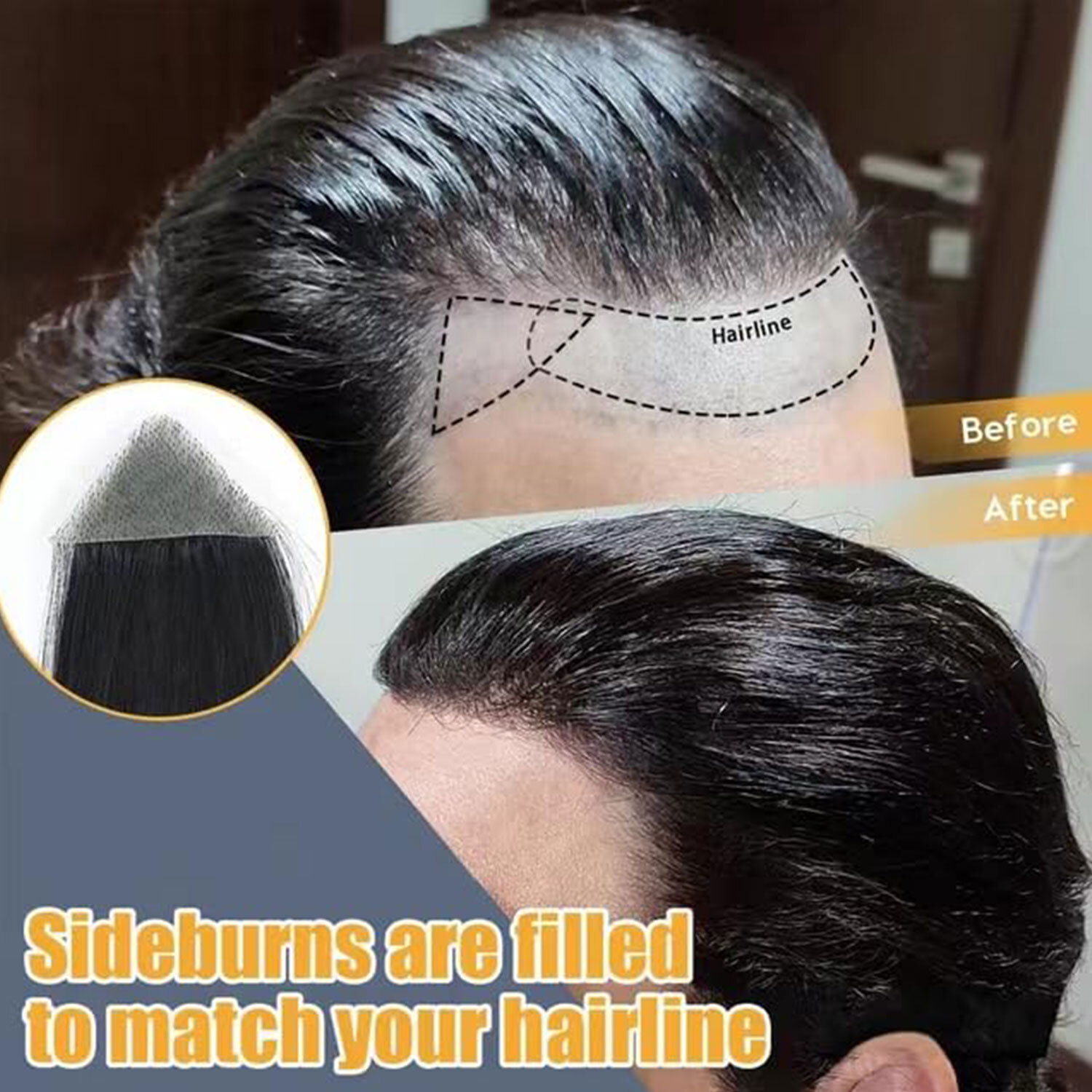 Front Hairline 100% Human Hair Patch Full Skin Base Cover-Up Topper Piece Toupee