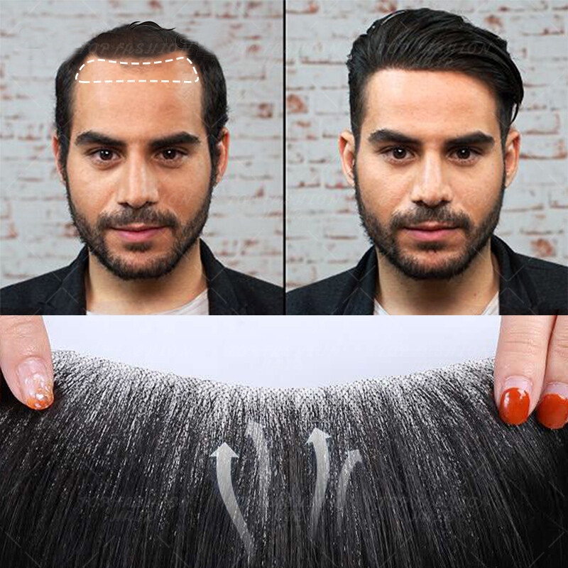 Mens Human Hair Injected Replacement System Toupee Remy Hair Piece PU LACE MONO