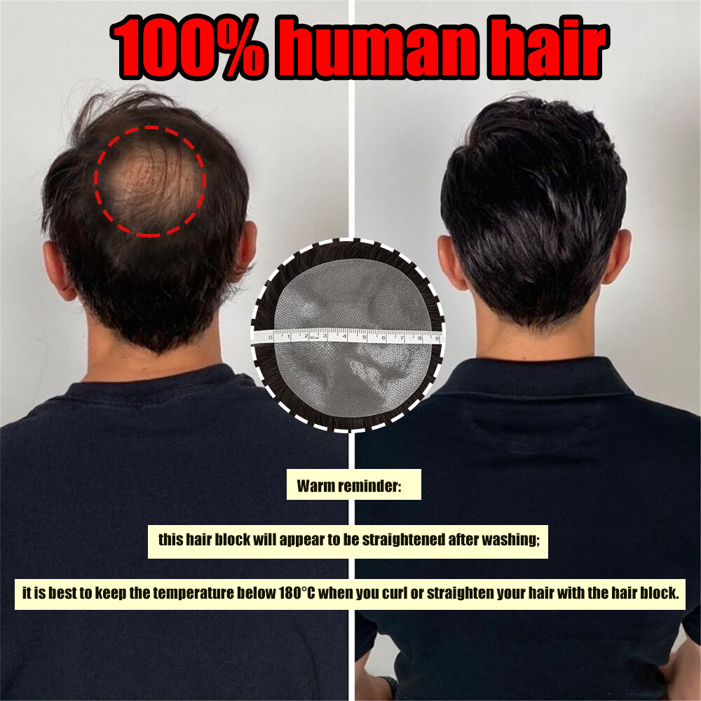 Men Frontal Hairline Temple Hair Patch Remy Human Hair Cover up Topper Bald Spot