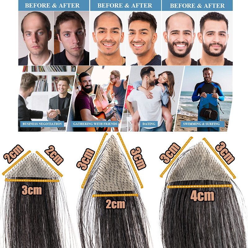 100% Human remy Hair Bald Spot Patch Toupee Forehead Hairpiece Hair Replacement