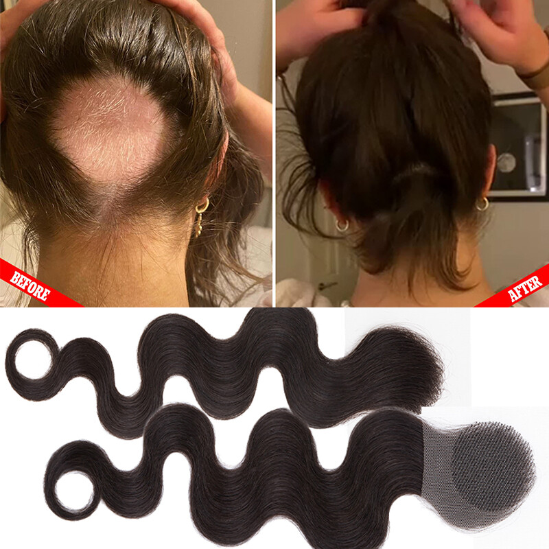 Human Hair Patch Full Lace Cover-up Topper Hairpiece for Women’s Alopecia Areata