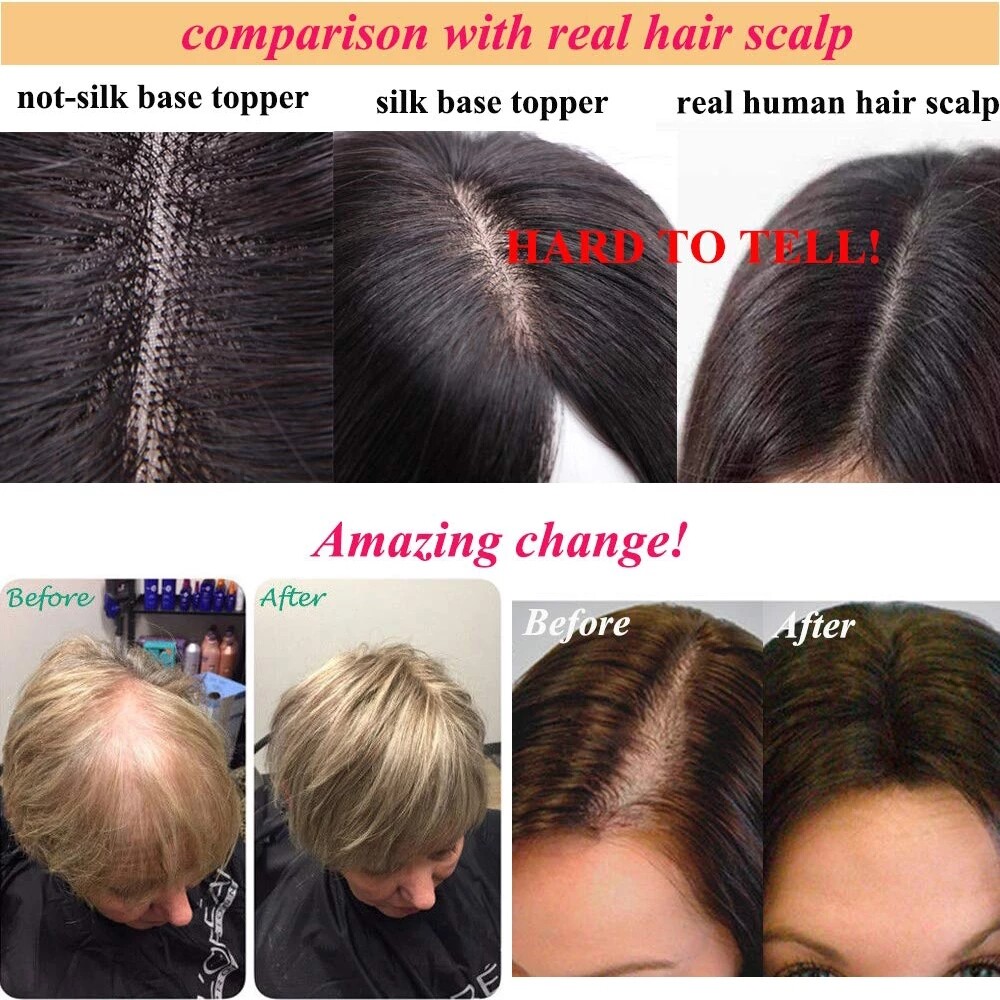 15x17cm Silk Base Human Hair Topper Breathable Silk Top Hair Piece for Women