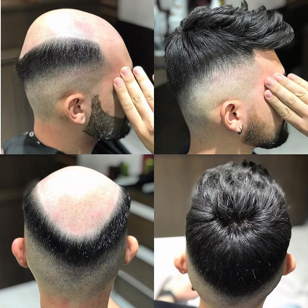 Natural Hair Thin Skin Human Hair Men Toupee Hair System Man Hair Prosthesis Wig