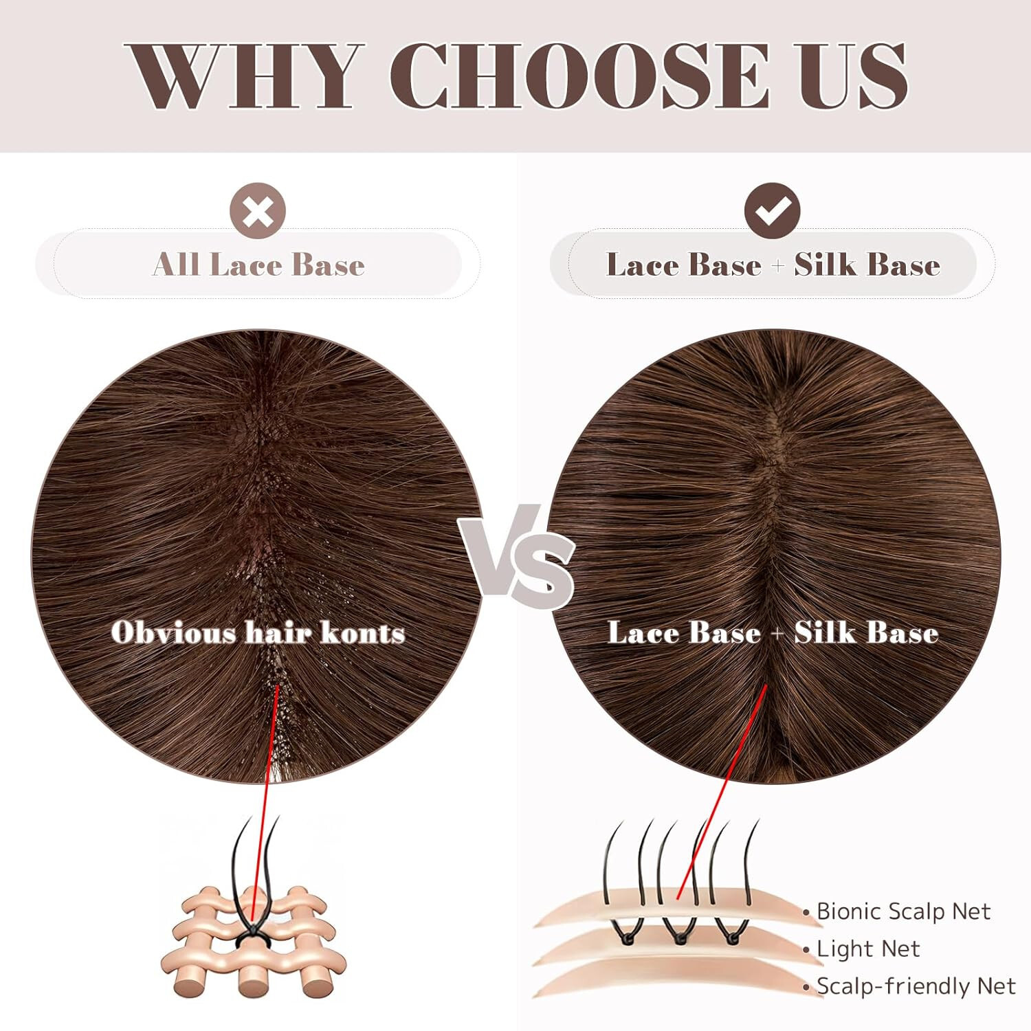 MY-LADY Human Hair Toppers for Women Real Human Hair 10 Inch Chocolate Brown