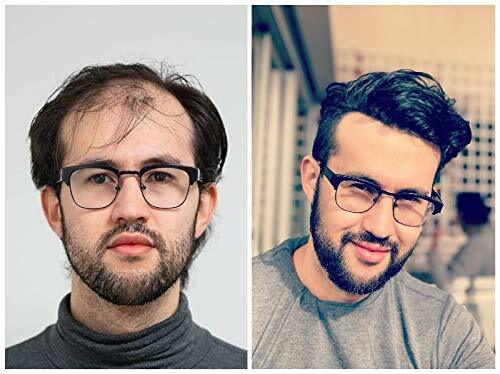 Mens Frontal Hairpiece V-Looped Covering Receding Hairline Human Black Hair