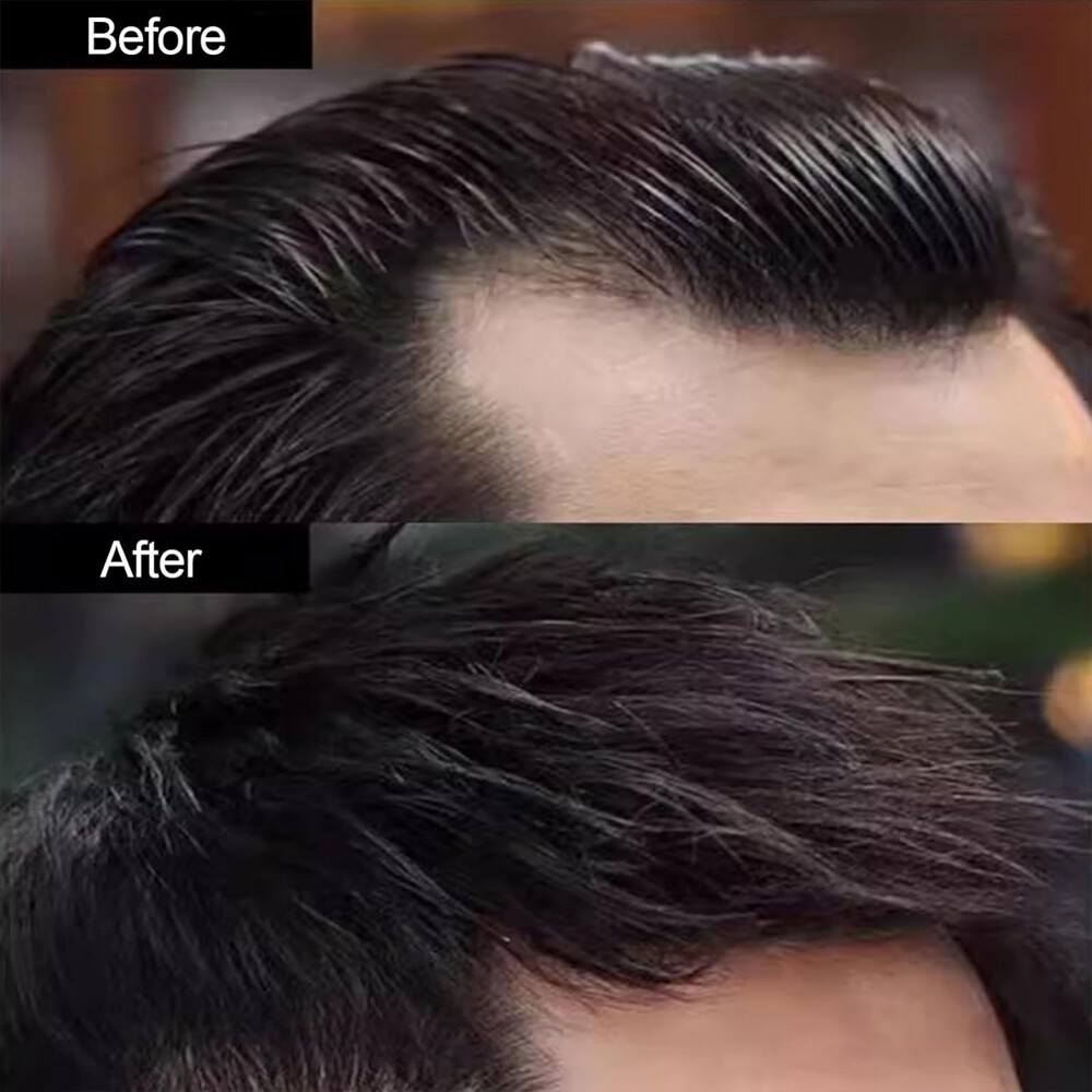 Temple Hair Patches Human Hair Pieces Skin Base Cover-Up Frontal Hairline Toupee
