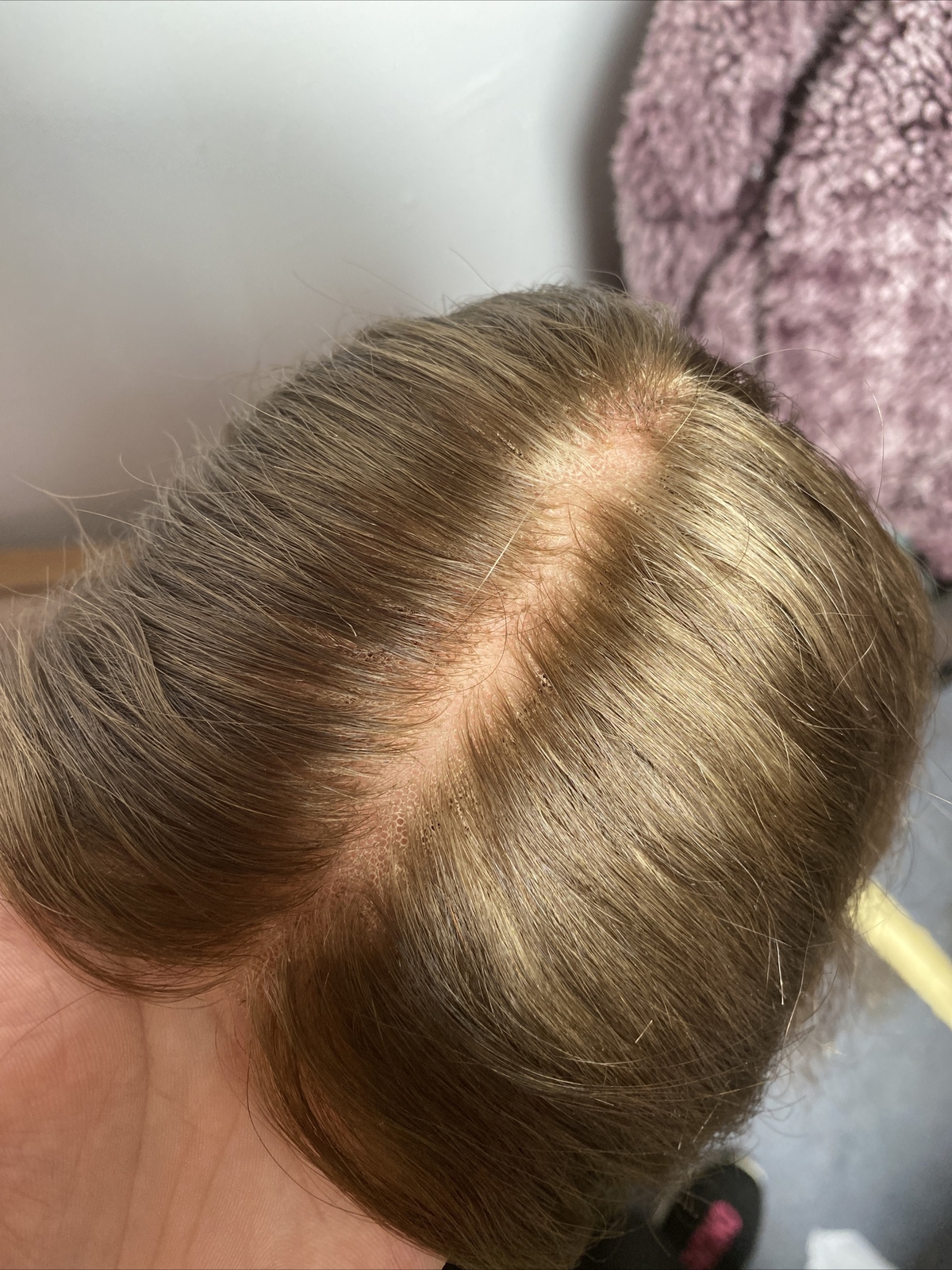 The Hair Mama Dark Blonde Human Hair Lace Front Hand Tied Wig Size Small