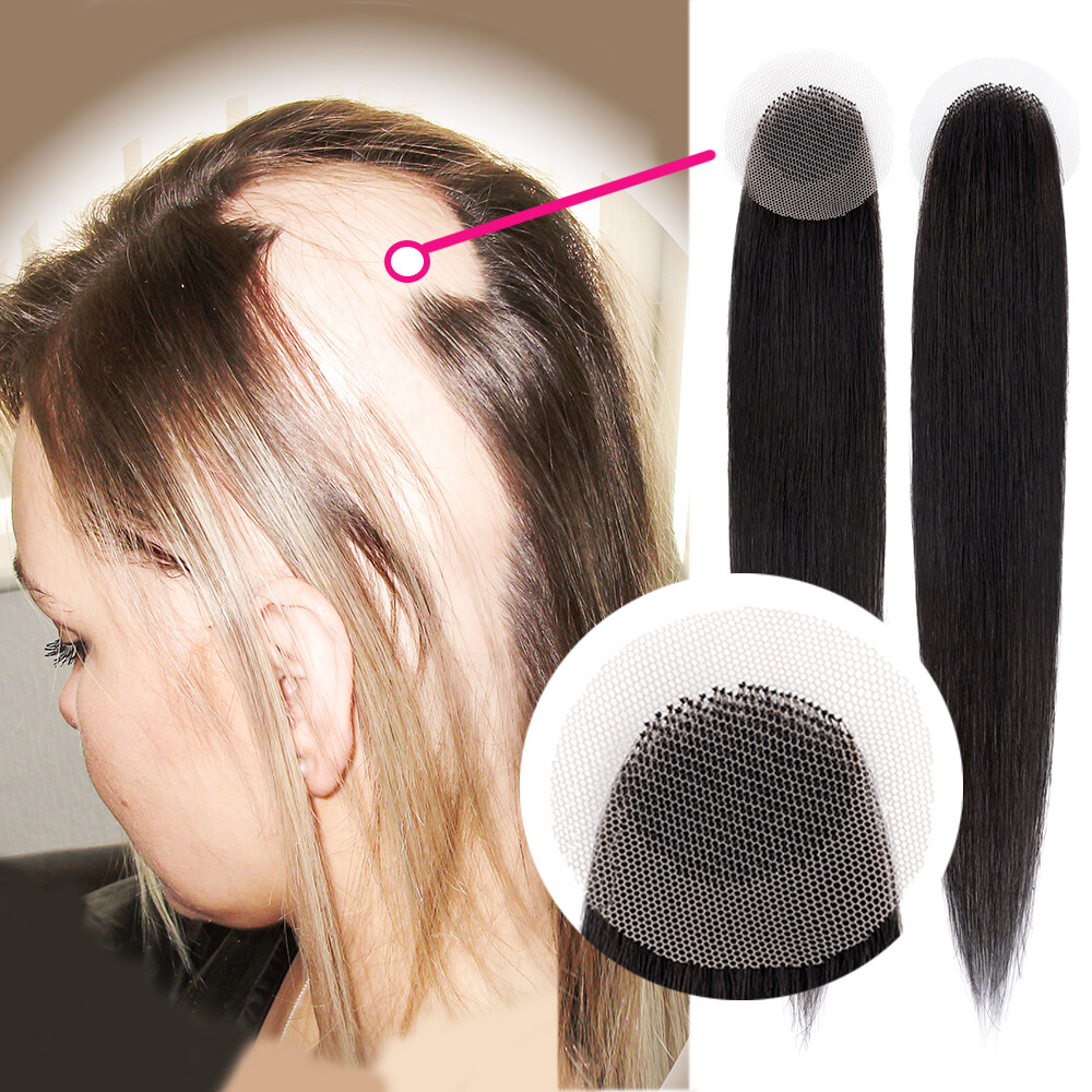 Full Lace Cover-up Tape Human Hair Patches Hairpiece for Alopecia Areata 8″ 18″