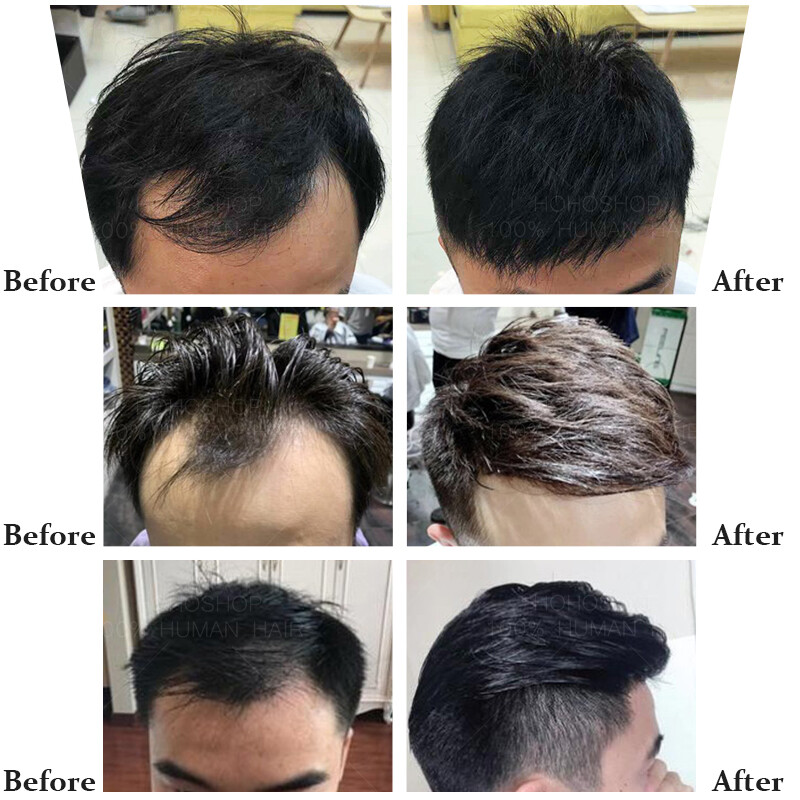 Mens Toupee Receding hairline Patch Thin Skin PU Bald Human Hair Piece System US