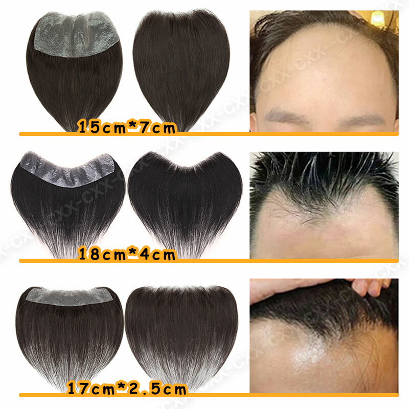 Mens Human Hair Replacement Toupee Thin Skin Frontal Hairpiece Forehead Hairline
