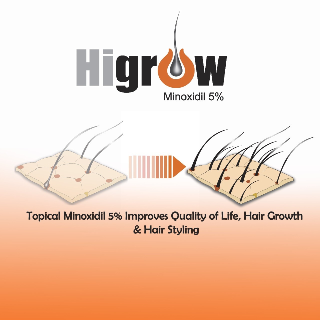 Minoxidil Hair Growth Spray for Men 5% Advanced Hair Regrowth Treatment. Hi- Gro