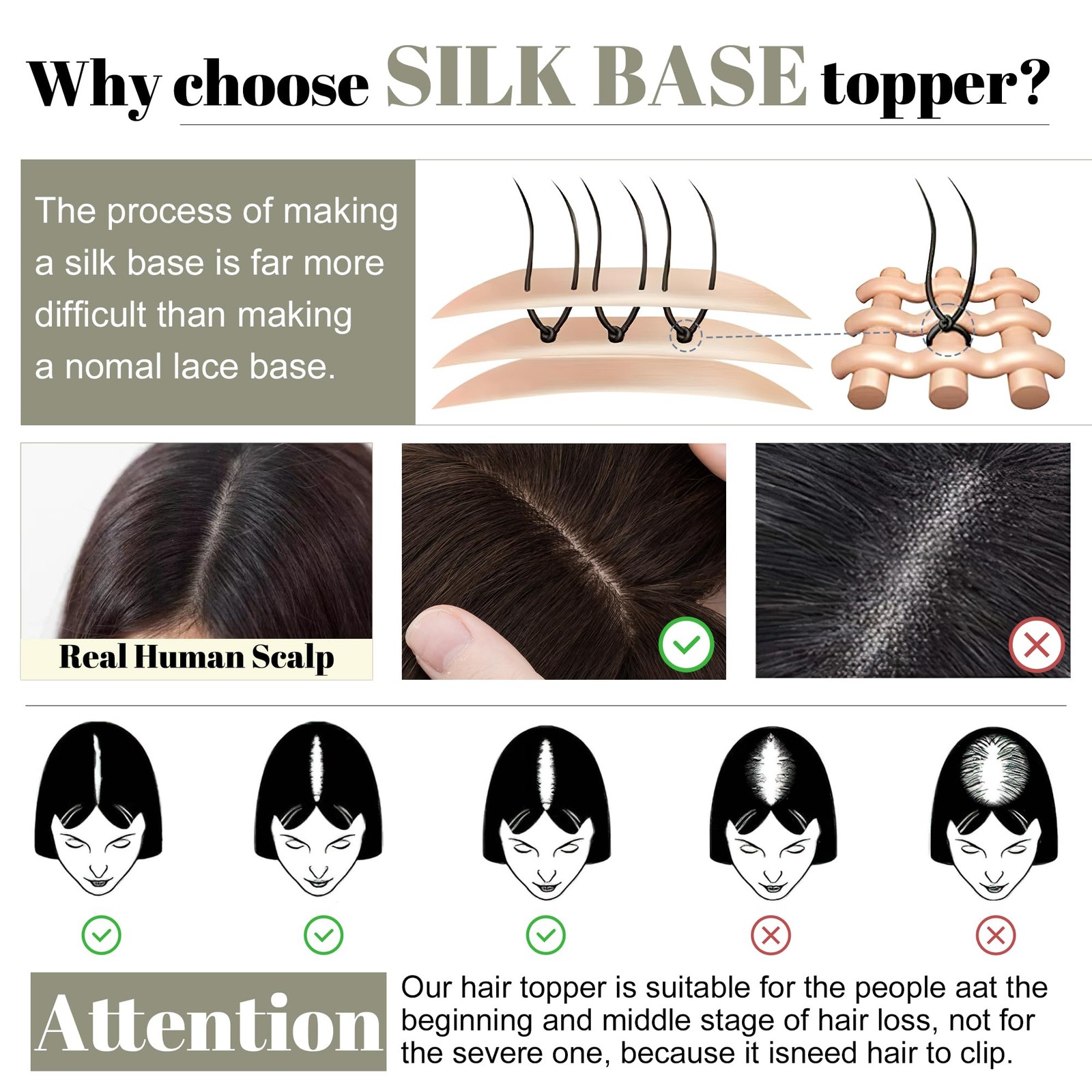 Sego Grey Hair Toppers For Women Real Human Hair Bangs Salt And Pepper Hair