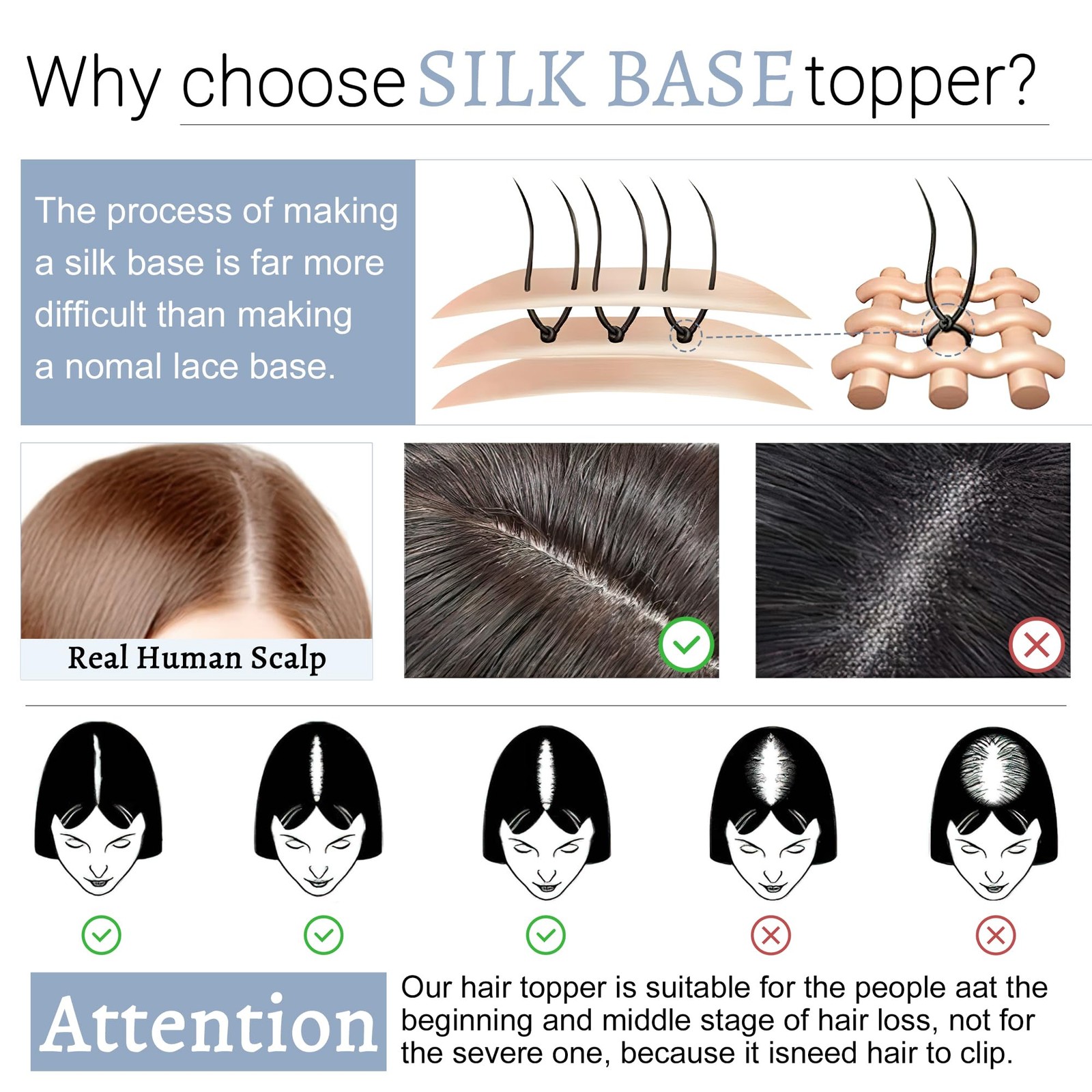 Segohair Hair Toppers For Women Real Human Hair Bangs 7 13 Cm Silk Base Clip In