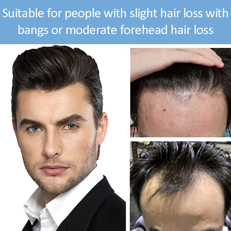Men Toupee Thin Skin PU 100% Remy Human Hair Frontal Receding Hairline Hairpiece