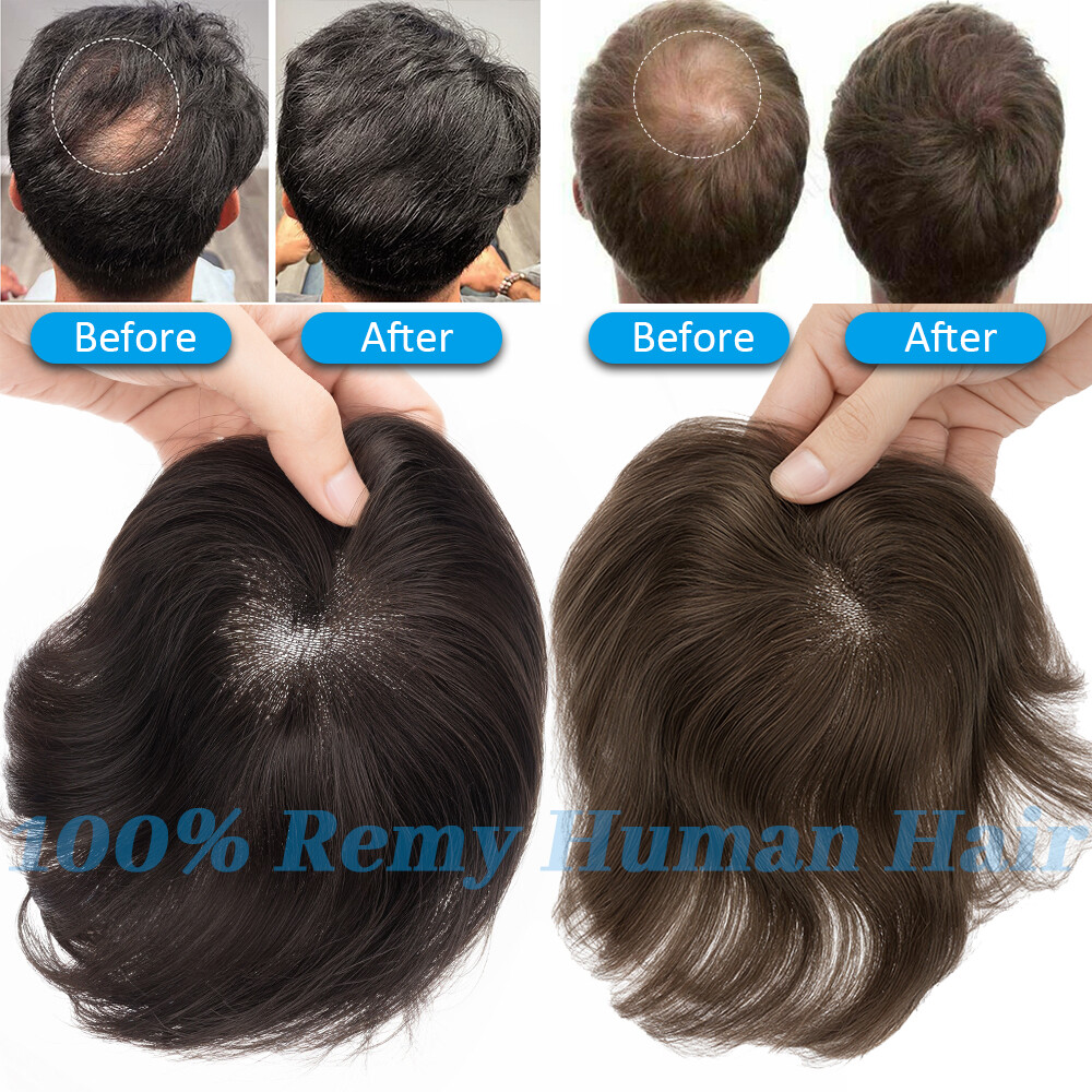 Men’s Remy Human Hair Patches Pieces Toupee for Top Head Hair Loss Thin Skin PU