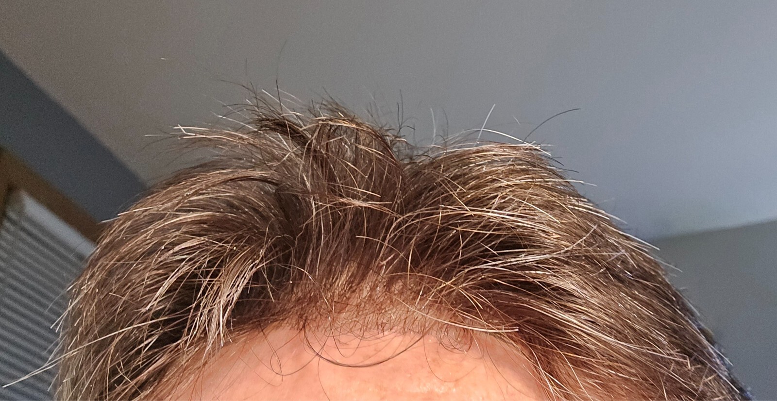 Mens Human Hairpiece Ultra Thin Skin (.03mm) Color #210 Darkest Brown 10%grey