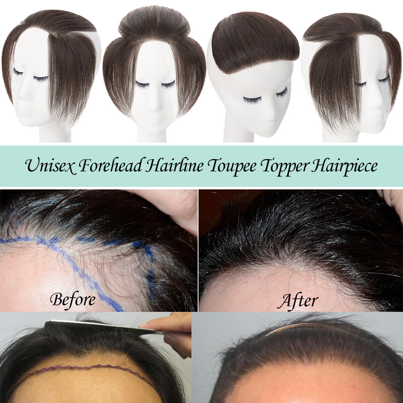 Mens Toupee 100% Remy Human Hair Frontal Receding Hairline Hairpiece Replacement