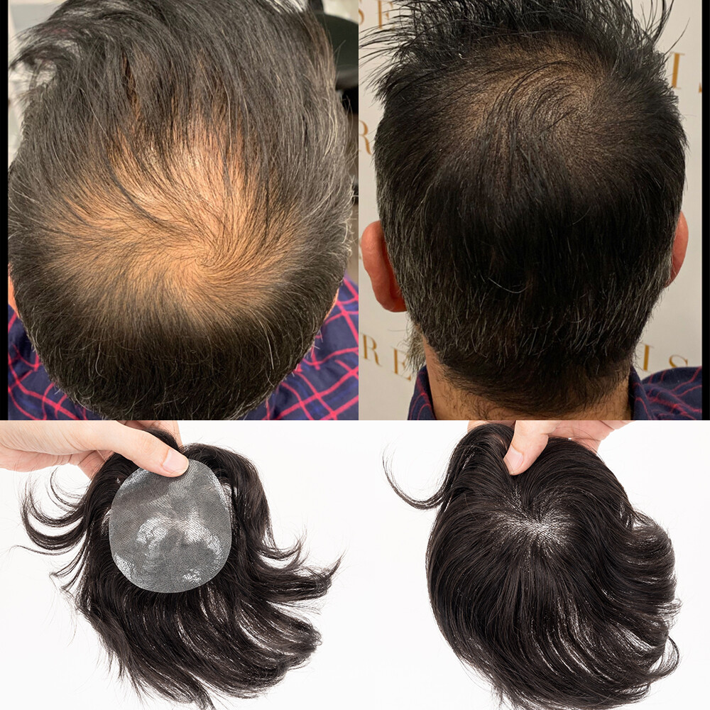 Bald Spot Hair Patch Toupee for Men Full PU Skin Base Cover-up Hair Patche Piece
