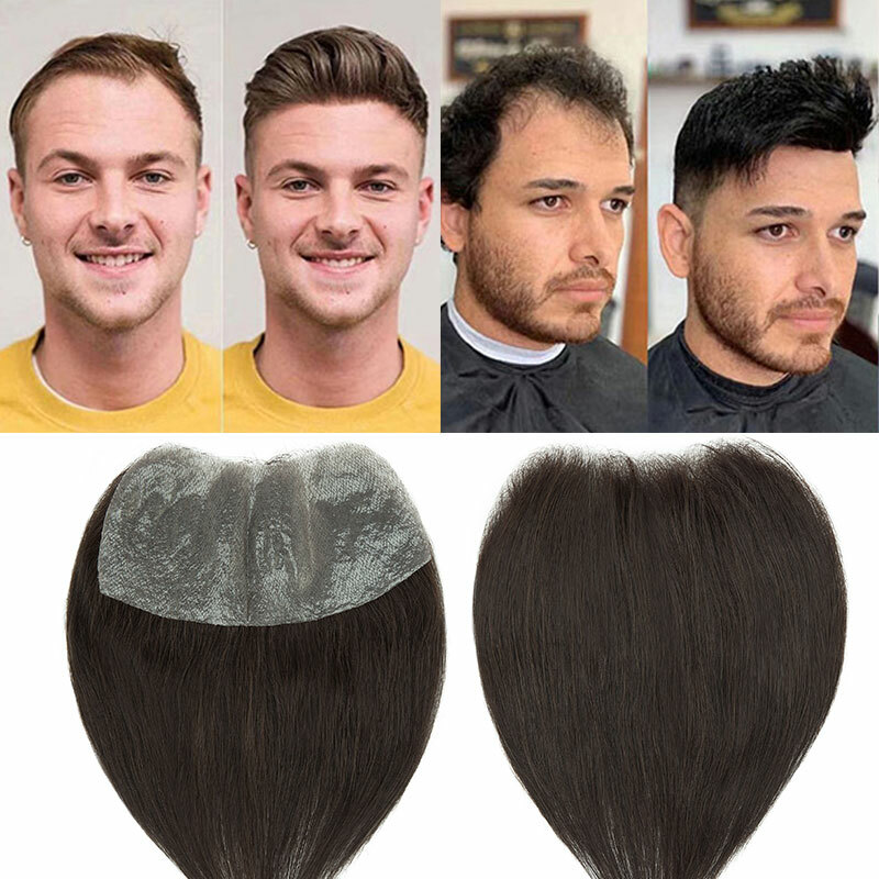 15×7 Forehead Hairline Thin Skin PU Toupee Topper Mens Remy Human Hair Piece Wig
