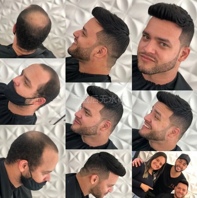 Mono NPU Men Toupee Durable Strong Knot Human Hair Replacement System Hairpiece