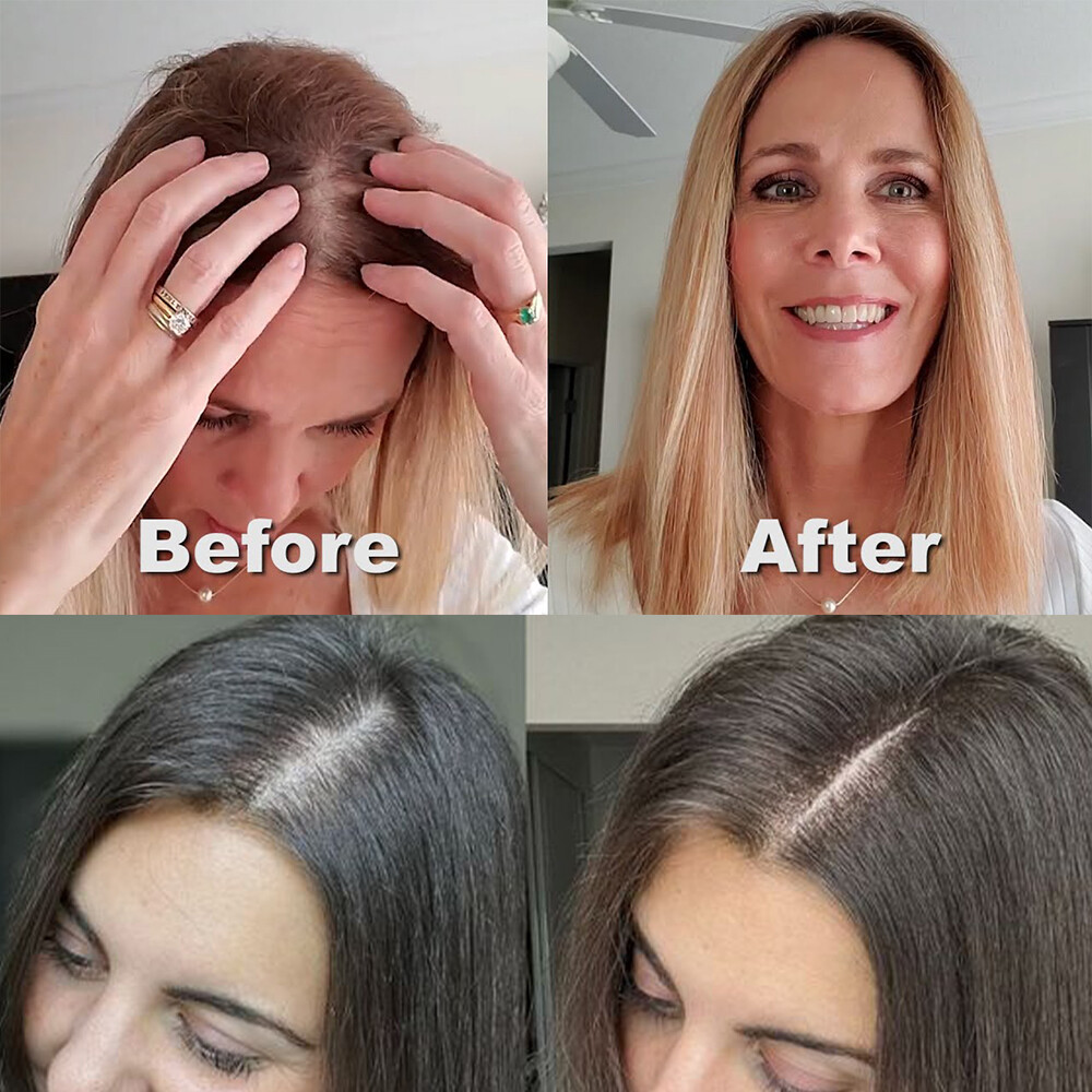 Women Topper Clip in Remy Human Hair Lace Base Hair Pieces Wide Hairline Part
