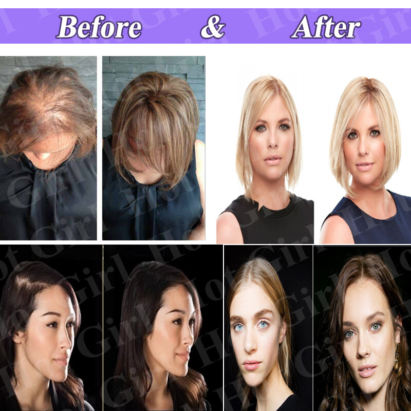 Mono Silk Base 100% Remy Human Hair Topper Clip In Top Hairpiece Wig Women Thick
