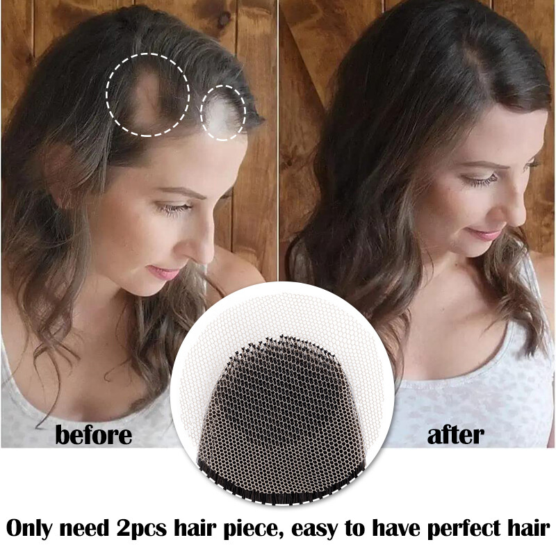 100% Human Hair Patch, Full Thin Skin Base Cover-up One Pieces for Hair Loss