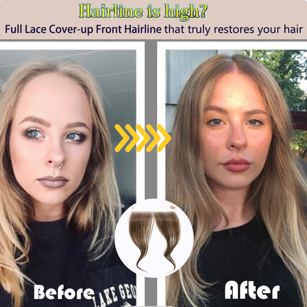 Lace PU Skin Cover-up Front Hairpiece Hand-Tied Hairline Real Human Hair Patches