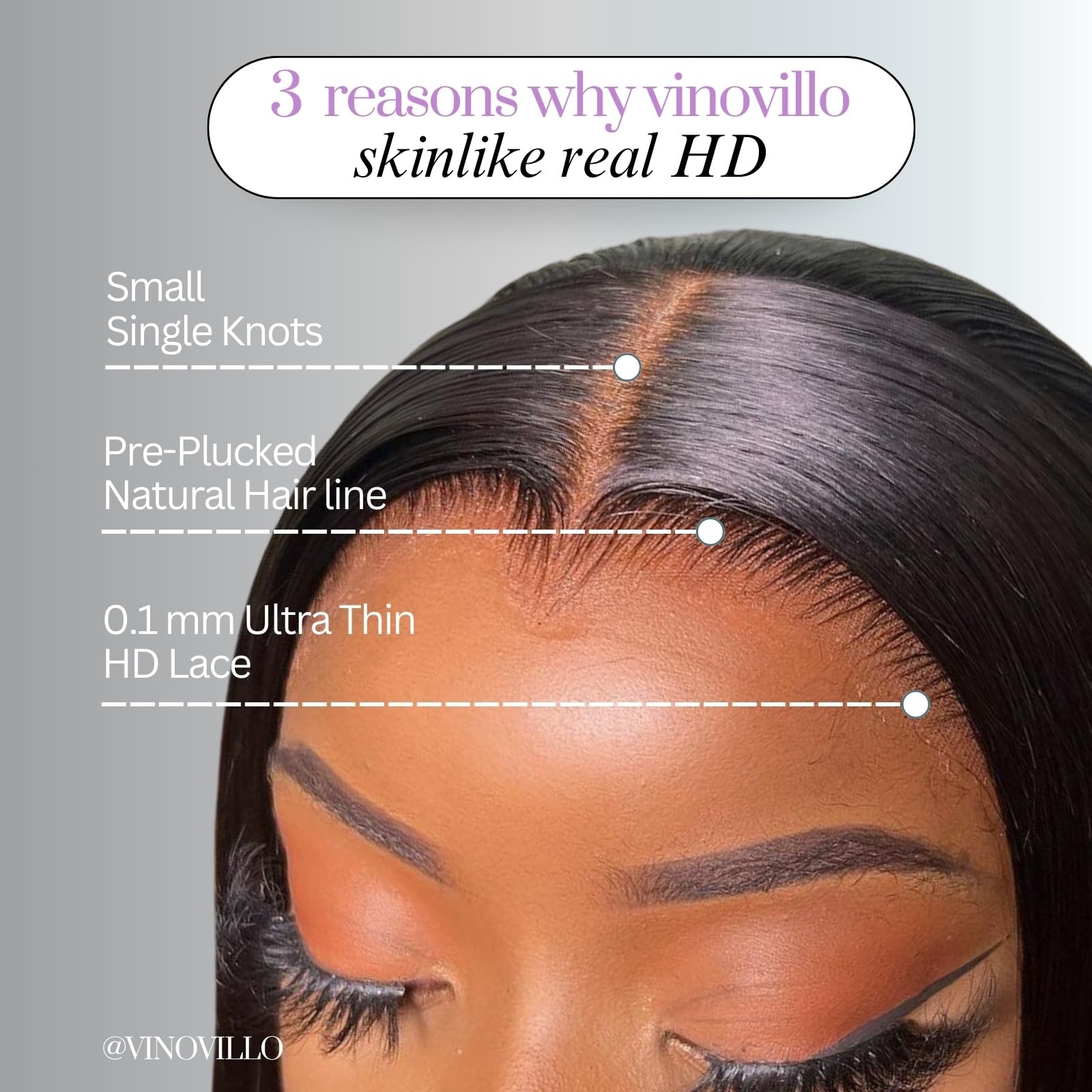 Vinovillo 6X6 Skinlike Real Hd Lace Closure Only Straight Ultra Thin Invisible