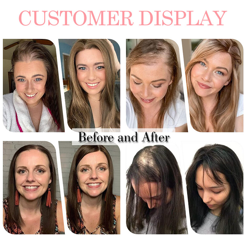 Hair Toppers Clip in Real Remy Human Hair Piece 130% Density Lace Base 8x10cm US