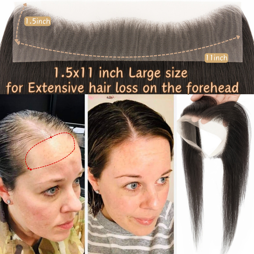 Full Lace Cover-up Front Hairline Hairpiece Remy Human Hair Patch Topper Toupee