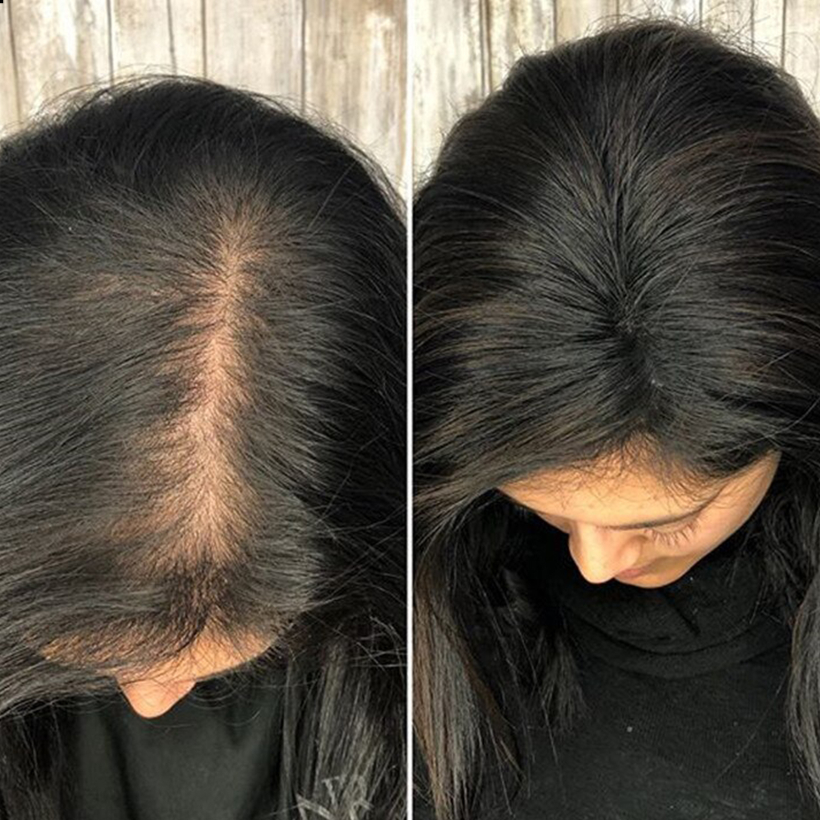 Topper Toupee Clip In Remy 100% Human Hair Lace Base Wiglet Hairpiece Hand-tied