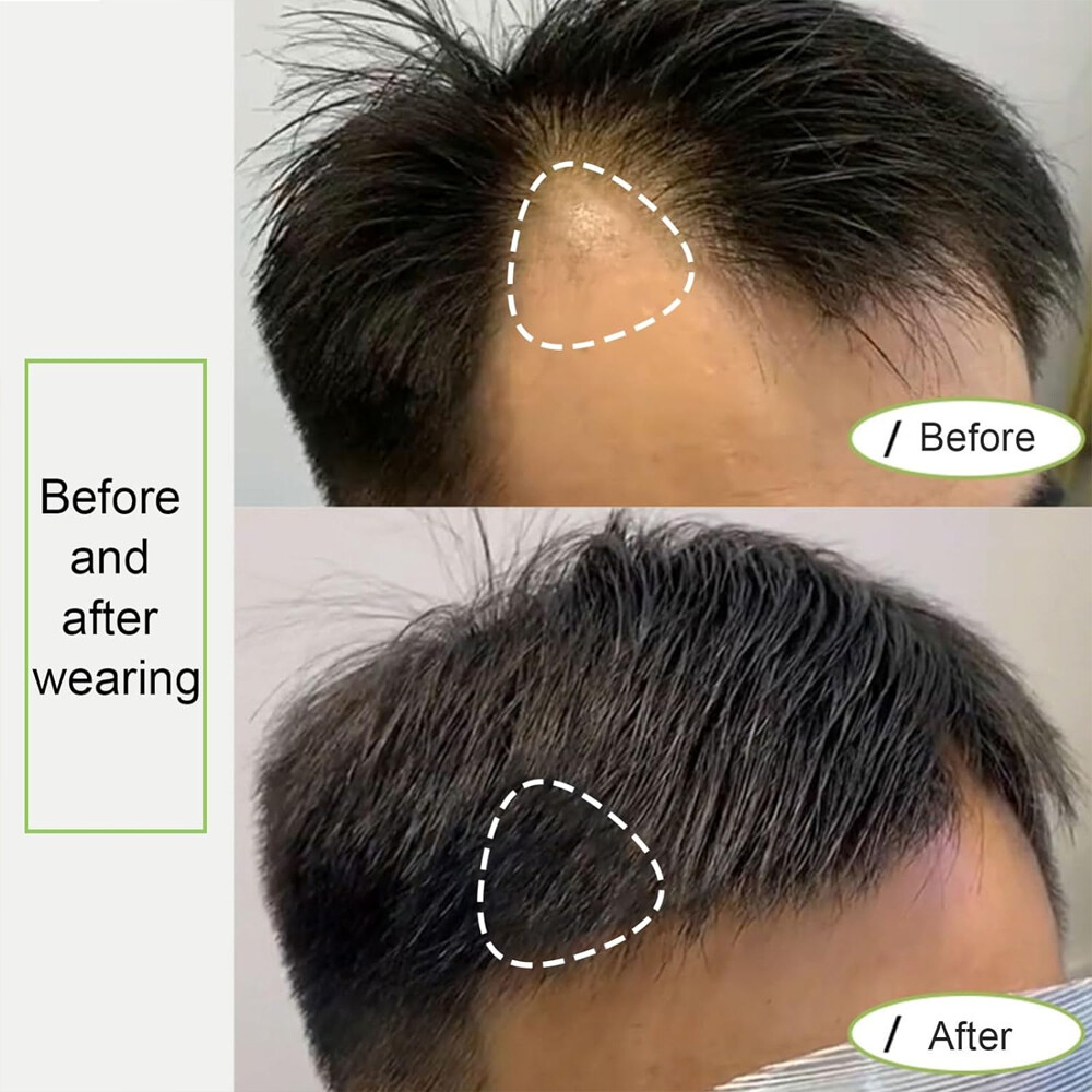 Temple Hair Patches Human Hair Pieces Skin Base Cover-Up Frontal Hairline Toupee