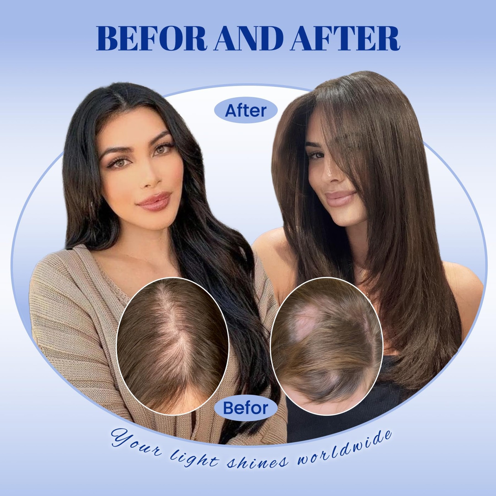 Worldstar Toppers For Women Real Human 3/8/22 Balayage Dark Brown Ombre Light